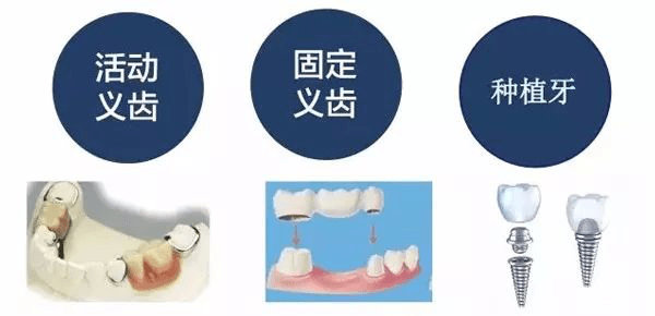 种植牙国家政策最新动态，推动口腔健康，提升全民幸福感