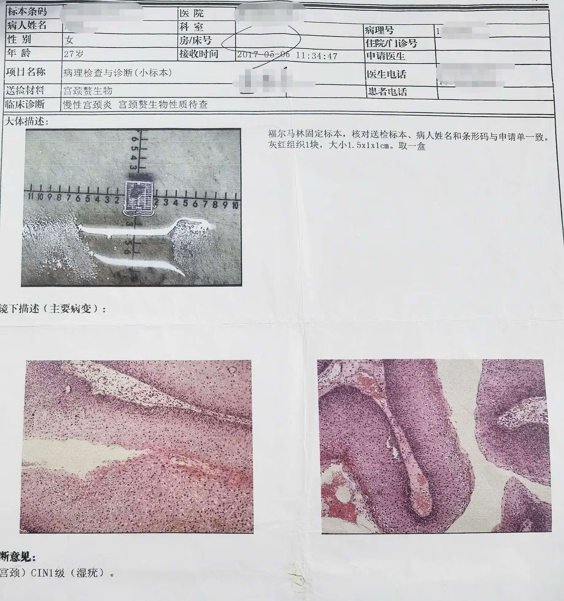 澳门正版资料免费大全新闻,and词语解析_尖锐湿疣ERJ34.49.91