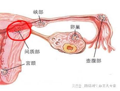 输卵管疏通价格表,输卵管疏通价格表，详细步骤指南